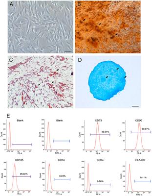 Phenotypic and Functional Characterizations of Mesenchymal Stem/Stromal Cells Isolated From Human Cranial Bone Marrow